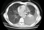 High dynamic range CT scan